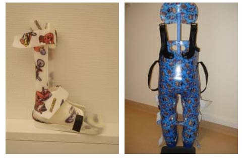 ispo-prothesis2